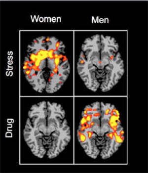 Brain Scans Image