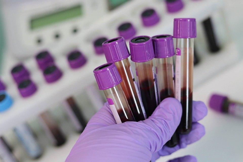 Blood Test Vial Image